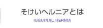 鼠径ヘルニアとは